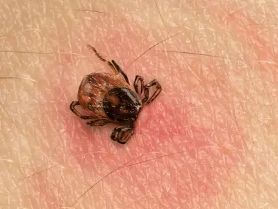 Tick embedded in skin