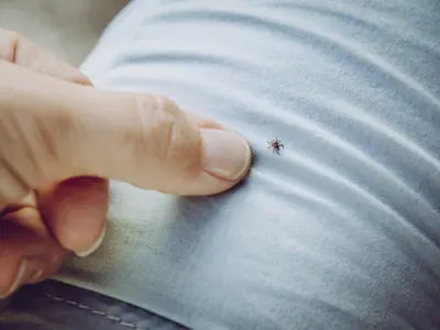 Tick on a person's pant leg with finger pointing at it.